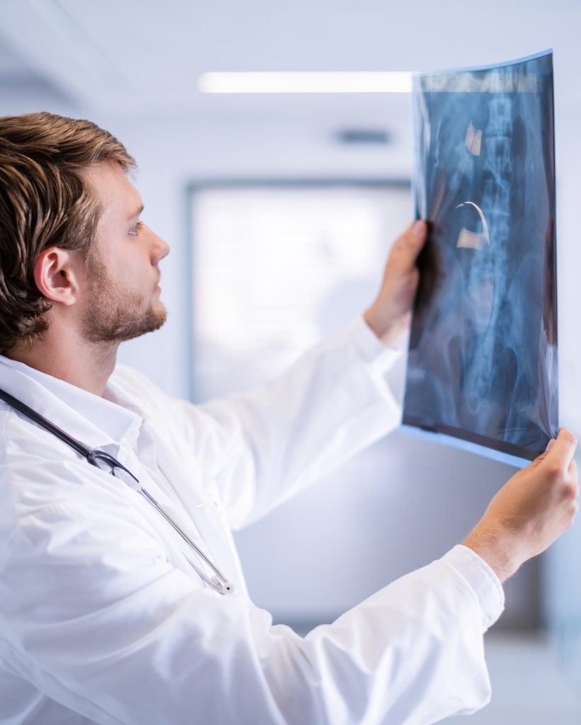Male doctor examining x-ray in corridor Male doctor examining x-ray in corridor